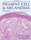 Pigment Cell & Melanoma Research期刊封面